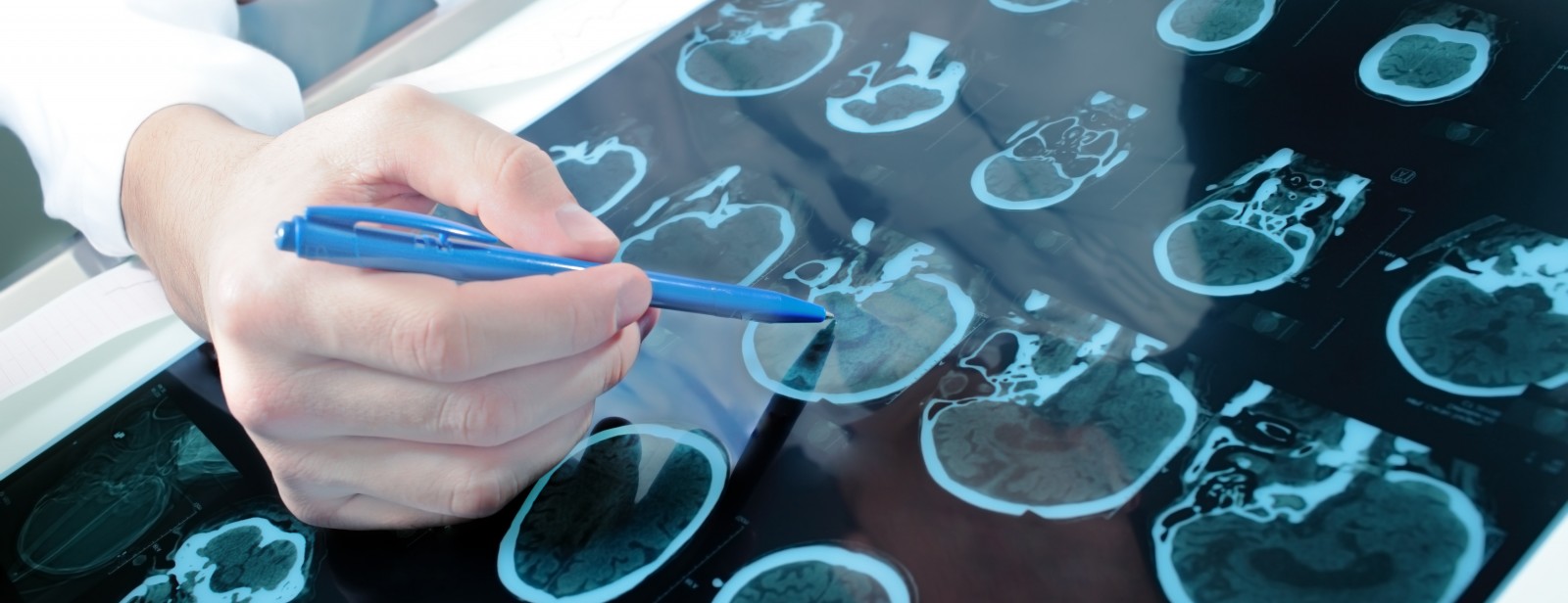 Doctor examines patient brain scan tomography for neuropsychology assessment